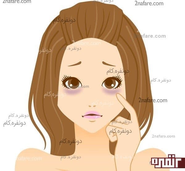 علت تیرگی دور چشم